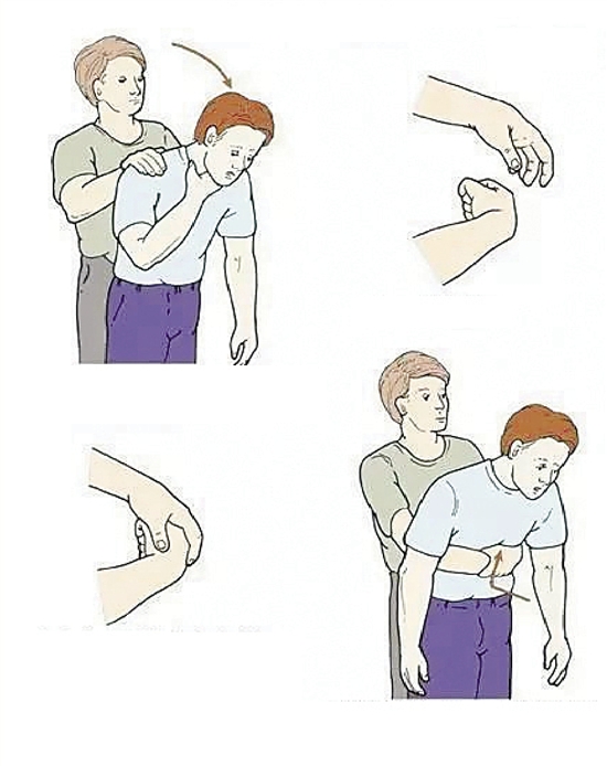 1528094870716762.jpg